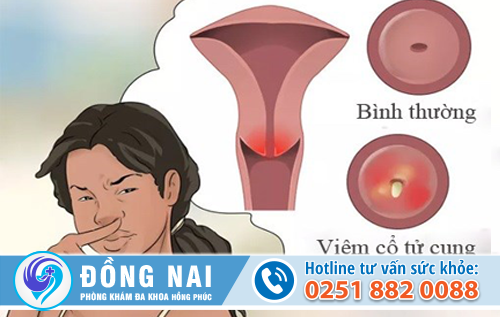 Âm đạo có mùi