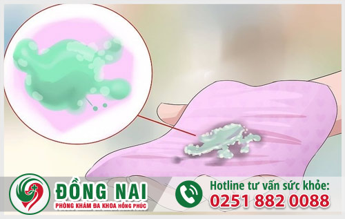 Âm đạo tiết dịch màu xanh là bệnh gì?