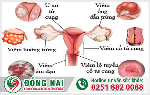 Nhận biệt bệnh phụ khoa thường gặp ở nữ giới