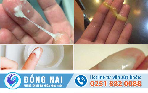 Cách trị bệnh huyết trắng