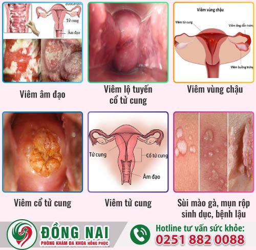 Chảy máu sau quan hệ có nguy hiểm không?