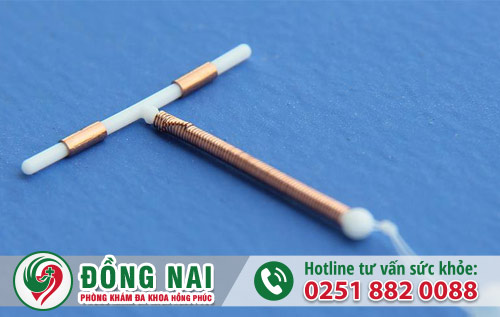 Hoang mang vì đặt vòng tránh thai vẫn có thai