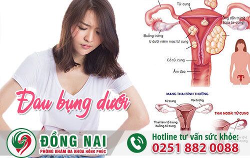 Đau bụng dưới ở nữ giới có thể là dấu hiệu của nhiều bệnh lý nguy hiểm