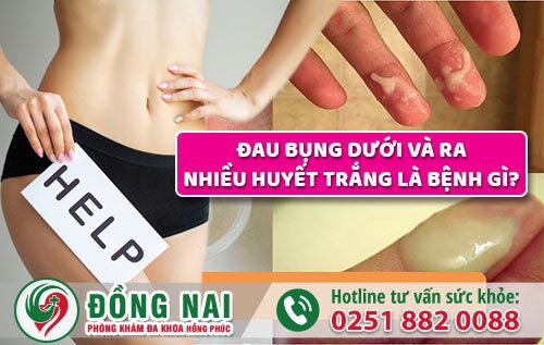 Đau bụng dưới và ra nhiều huyết trắng nguy cơ tiềm ẩn bệnh gì?