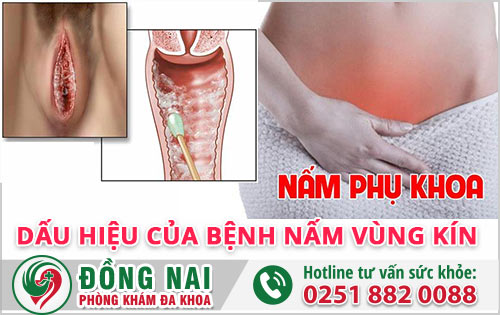 Dấu hiệu của bệnh nấm vùng kín và những nguy cơ tiềm ẩn