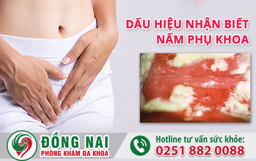 Nấm phụ khoa gây ra nhiều ảnh hưởng cần được thăm khám ngay