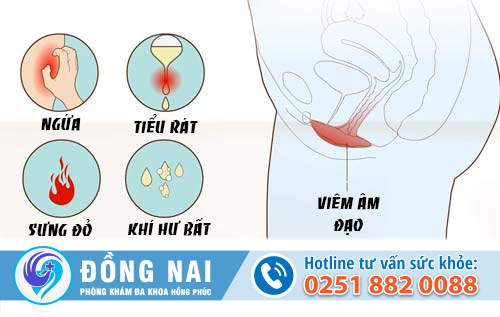 Triệu chứng của viêm âm đạo