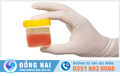 Đi tiểu ra máu sau khi quan hệ ở nữ là hiện tượng gì?