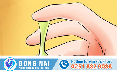 Dịch âm đạo có màu vàng xanh có nguy hiểm không?