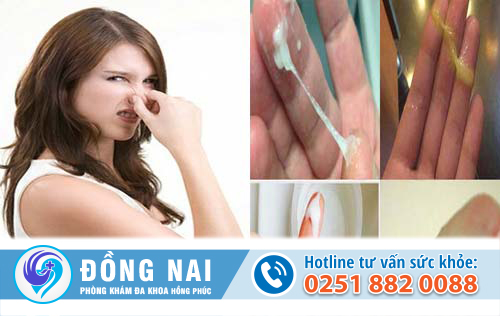 Huyết trắng có màu kèm mùi hôi