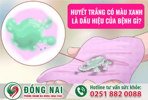 Huyết trắng có màu xanh là dấu hiệu của bệnh gì?