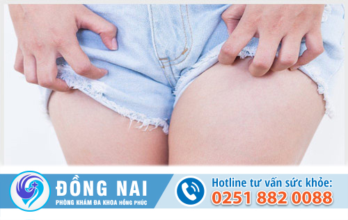 Khắc phục ngứa âm đạo trong chu kỳ kinh nguyệt