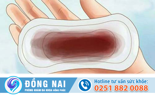 Kinh nguyệt màu nâu và cách chữa