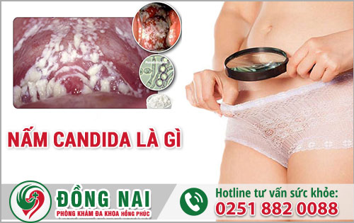 Nấm Candida là gì - Thủ Phạm Gây Viêm Nhiễm Vùng Kín