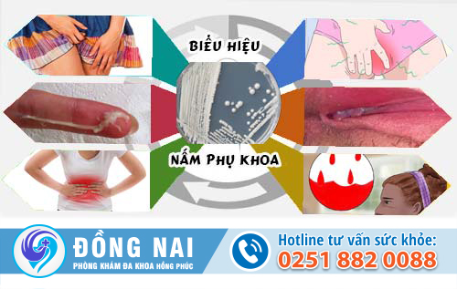 Làm sao biết bạn có đang bị nấm phụ khoa và cần điều trị?