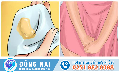 Nấm vùng kín nữ giới và cách chữa trị hiệu quả