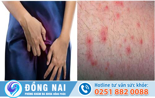 Ngứa bộ phận sinh dục nữ