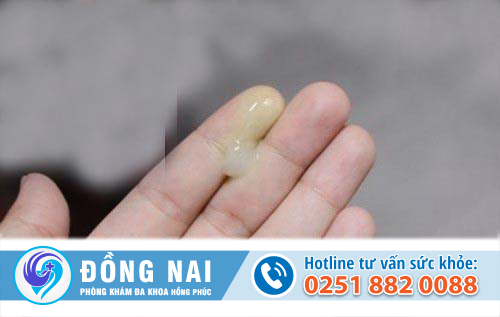 Nguyên nhân khiến khí hư ra nhiều là gì?