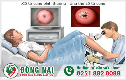 Ung thư cổ tử cung gây ra tình trạng ra máu sau quan hệ