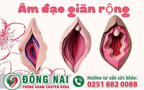 Se Khít Vùng Kín Giúp Chị Em Giữ Gìn Hạnh Phúc Gia Đình