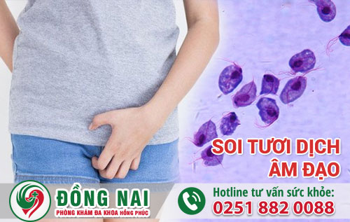 Kiểm tra, soi tươi dịch âm đạo là như thế nào?