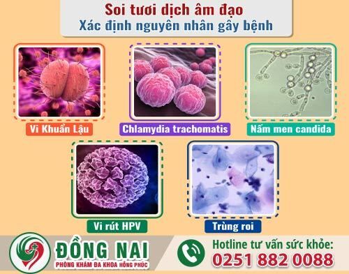 Kiểm tra, soi tươi dịch âm đạo là như thế nào?