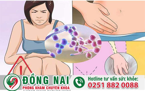 sức khỏe phụ khoa vị nhiễm nấm men phải làm sao để khắc phục?