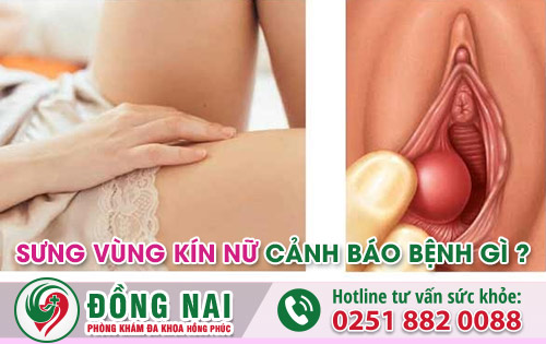 Sưng vùng kín cảnh báo nhiều bệnh lý nguy hiểm