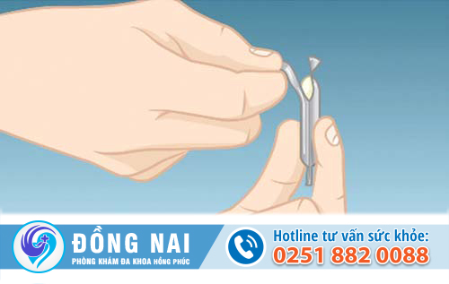 Thuốc đặt gynecon có hiệu quả không?
