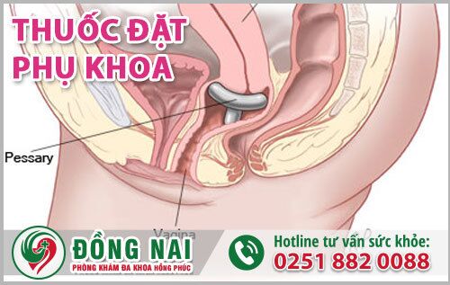 Làm thế nào để đặt thuốc phụ khoa và cách bảo quản thuốc tốt nhất