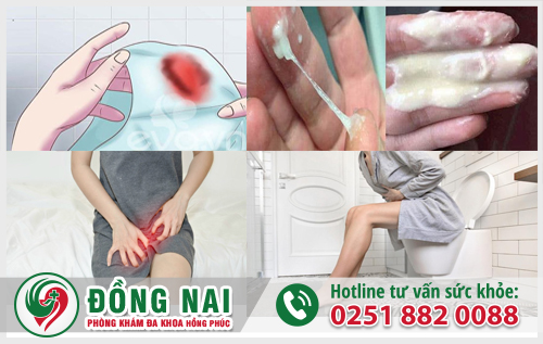 Các triệu chứng thường gặp của bệnh phụ khoa