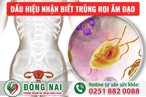 Dấu hiệu nhận biết trùng roi âm đạo và cách điều trị hiệu quả