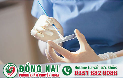 Ung thư cổ tử cung bao gồm các dấu hiệu cảnh báo nào không nên bỏ qua