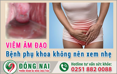 Viêm Âm Đạo - Bệnh Phụ Khoa Không Nên Xem Nhẹ