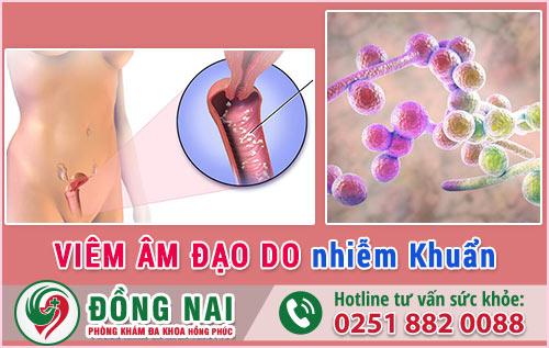 Viêm Âm Đạo Do Nhiễm Khuẩn
