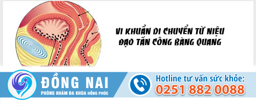 Đi tiểu nhiều do viêm bàng quang