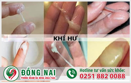 Khí hư bất thường là 1 trong những dấu hiệu rõ nét báo hiệu chị em đang bị viêm nhiễm phụ khoa