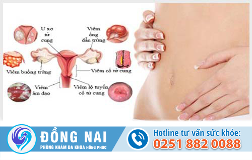 Viêm phụ khoa là bệnh gì?