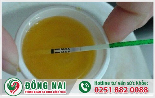 Xét nghiệm có thai bằng nước tiểu