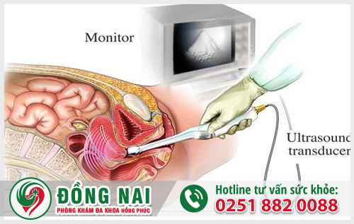 Xét nghiệm có thai bằng siêu âm đầu dò