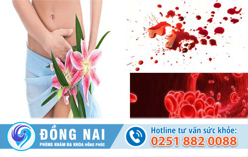 Xuất huyết cổ tử cung ở nữ giới là gì?